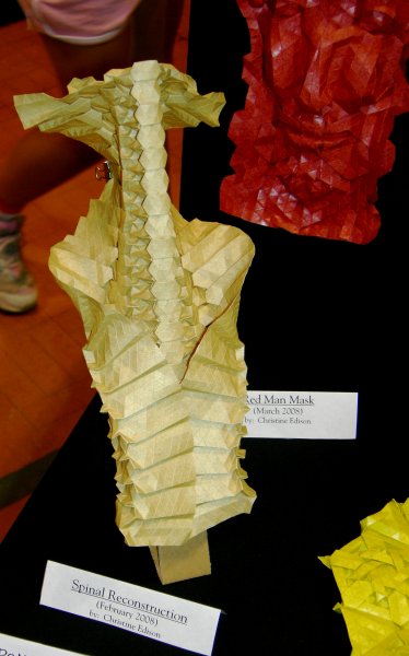 Spinal Reconstruction and Red Man Mask