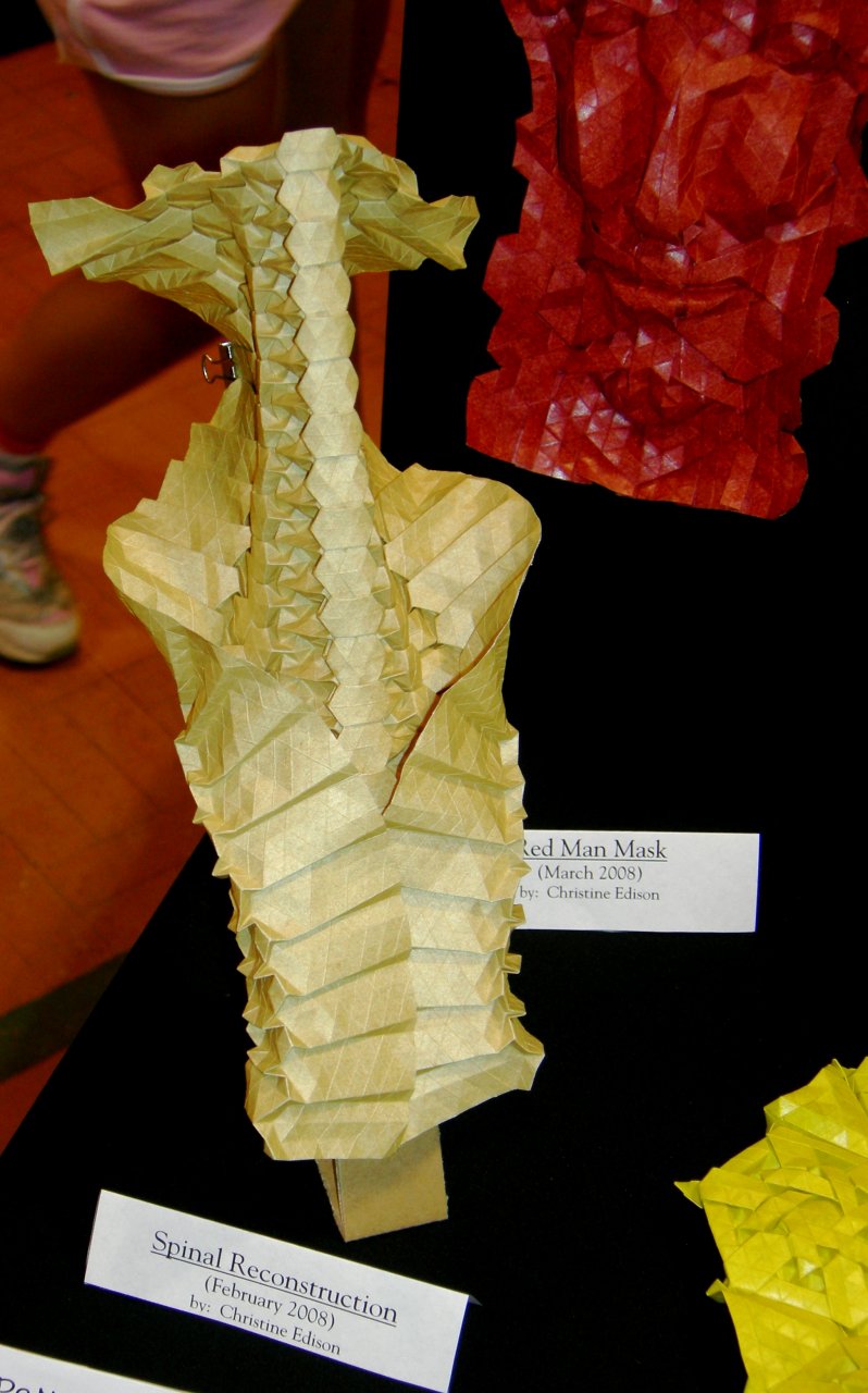 Spinal Reconstruction and Red Man Mask